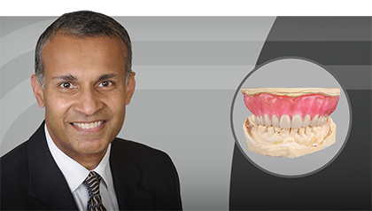 Dentures: Tips and Tricks for the Try-in Appointment Hero Image image