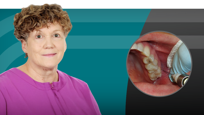 Success with Local Anesthesia: Maxillary Arch Techniques image